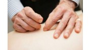 Acupuncture