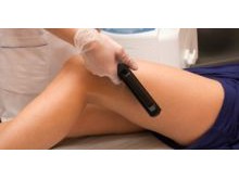 Laser Hair Removal