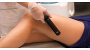 Laser Hair Removal NJ