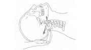 Craniosacral Therapy